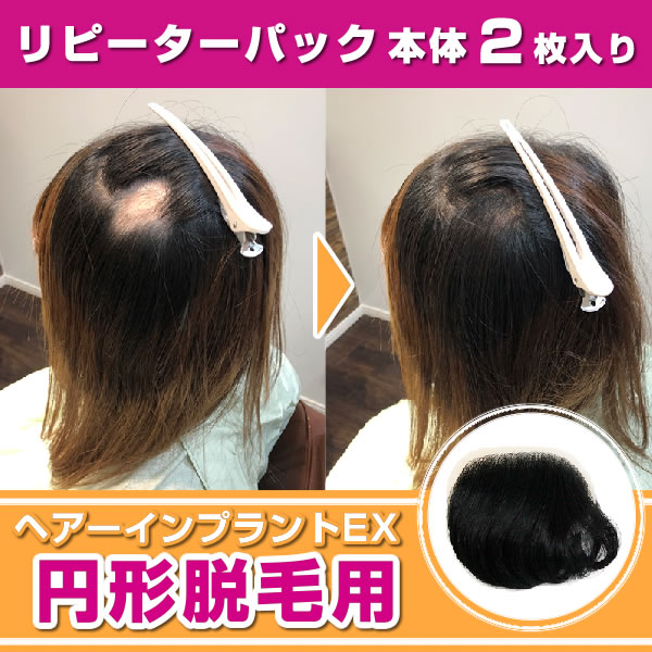 （リピーターパック）ヘアーインプラントEX 円形脱毛症用（部分かつら）※装着にはテープかシリコンのが..