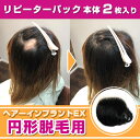 （リピーターパック）ヘアーインプラントEX 円形脱毛症用（部分かつら）※装着にはテープかシリコンのが必要です