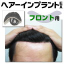 ヘアーインプラントEX フロント用(部分かつら)※装着には別途、強力テープかスーパーシリコンの購入が必要です