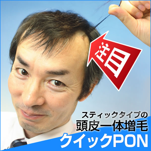 【全額返金保証】クイックPON 増毛 植毛 かつら 抜け毛 メンズ レディース ウィッグ