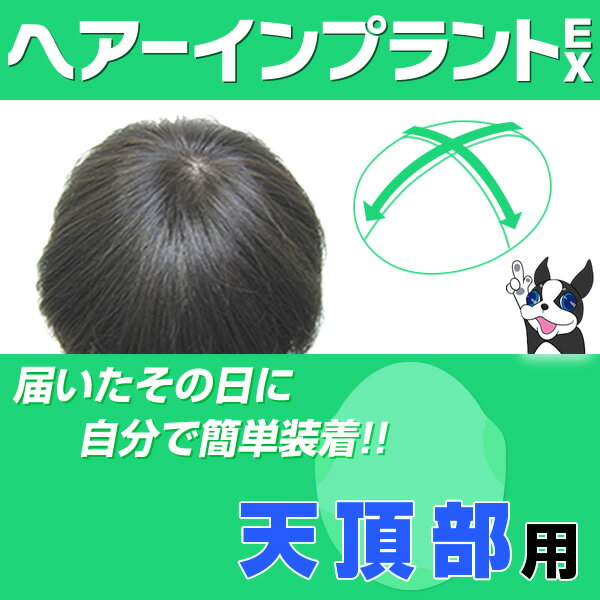 ヘアーインプラントEX天頂部用(部分かつら・男性用)※装着にはテープかシリコンが必要です