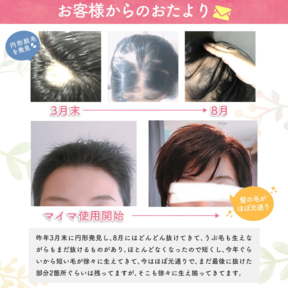育毛剤女性用マイマ(maima)薬用育毛ヘアローション100ml産後の脱毛、抜け毛、産後の女性用育毛剤として、妊活スタイルBaby-moひよこクラブPre-moにも掲載【医薬部外品】無添加だから安心!送料無料でお届け。
