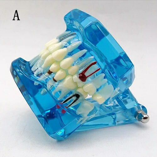 NEW! 歯科口腔モデル ボディ モデルを修正 取り外し可能 インプラント活動歯 tbq044