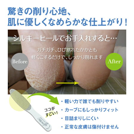 【シルキーヒール(ホワイト)】フットケア/かかとつるつる・角質除去/高級ダイヤモンドかかとやすり/滅菌可/日本製<1年間保証付>