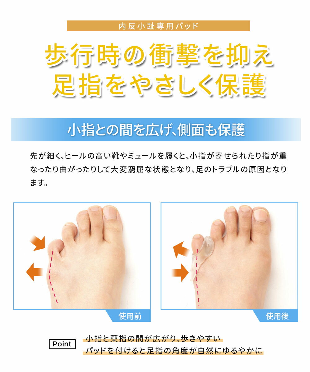 内反小趾 サポーター シリコン 小指 保護 2個入 ジェル パッド ぷにぷに 柔らかい 洗える 水洗い 予防 浮指 寝指 補整 保護 浮き 指 痛み 緩和 グッズ 歩行 靴 圧迫 摩擦 足指 ゲル素材 クッション 指の付け根 サポート セルフケア フットケア 簡単装着 小指ゲルパッド 182
