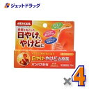 【第2類医薬品】パンパス軟膏 15g ×4個〔日やけ・やけど〕