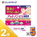 ≪1日はジェットの日!全商品P2倍!≫【第2類医薬品】アットノンEX ジェル 15g ×5個