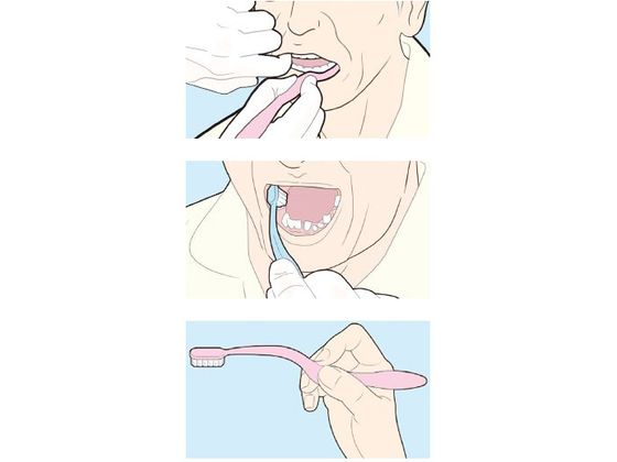 【お取り寄せ】ライオン歯科材 エラックハブラシ 620 S(ソフト) 6本セット