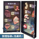喫煙の害 保健教育模型ディスプレイ OMH-79601 収納しやすい 健康 啓蒙 模型 肺気腫 COPD 肺がん 禁煙 啓蒙 生活指導 保健指導 教材 講演会 ...