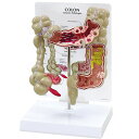 人体百科 楽天市場店で買える「人体模型 大腸 疾患 モデル OM-GP-3340 GPI Anatomicals クローン病 潰瘍性大腸炎 ポリープ 虫垂炎 消化器科 患者説明 医学 学習用 教材 送料無料」の画像です。価格は20,900円になります。