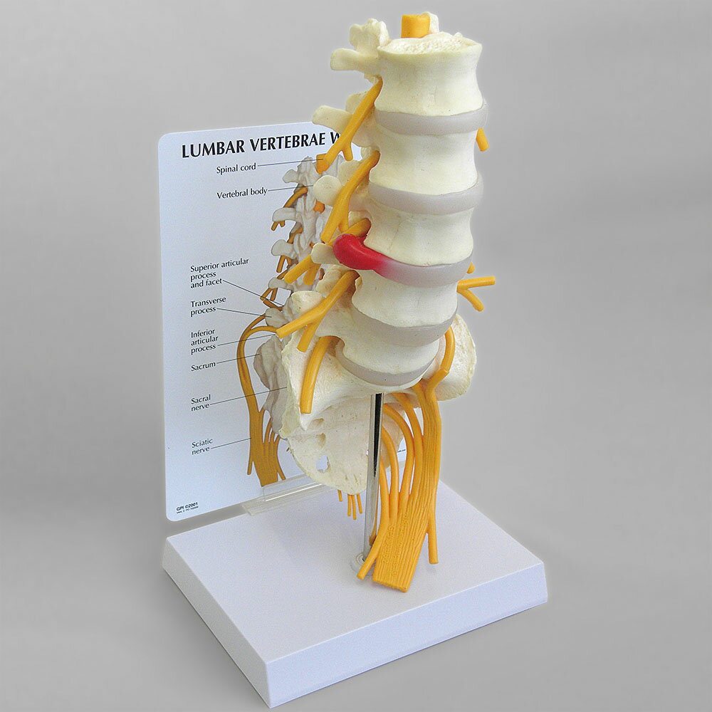 人体模型 腰椎5個と仙骨 OM-GP-1700 日本語訳付き GPI Anatomicals