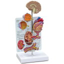 人体模型 高血圧 影響 OM-GP-4000 GPI Anatomicals 脳 眼 心臓 腎臓 動脈硬化 生活習慣病 患者説明 医学 学習用 教材 送料無料