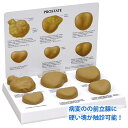 医学模型 前立腺疾患 OM-GP-3000 日本語訳付き GPI Anatomicals 前立腺 疾患 模型