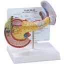 医学模型 膵臓と周辺諸疾患 OM-GP-3330 日本語訳付き GPI Anatomicals 膵臓 すい臓 疾患 模型