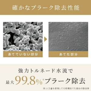 ヤーマン 口腔洗浄機器 YOI-2000W YA-MAN ジェットフロスEX [YOI2000W]