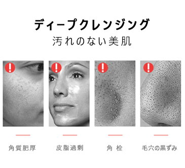 【即納】 美顔器 超音波ピーリング ウォーターピーリング 毛穴 ケア 美容 スマートピール 防水 クレンジング 皮脂汚れ 黒ずみ ピーリング 角栓 鼻 イオン導入 引き締め プレゼント