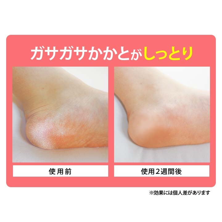 かかとつるつる甲メッシュサポーター2枚入 かかとケア 左右兼用 男女兼用 フットケ...