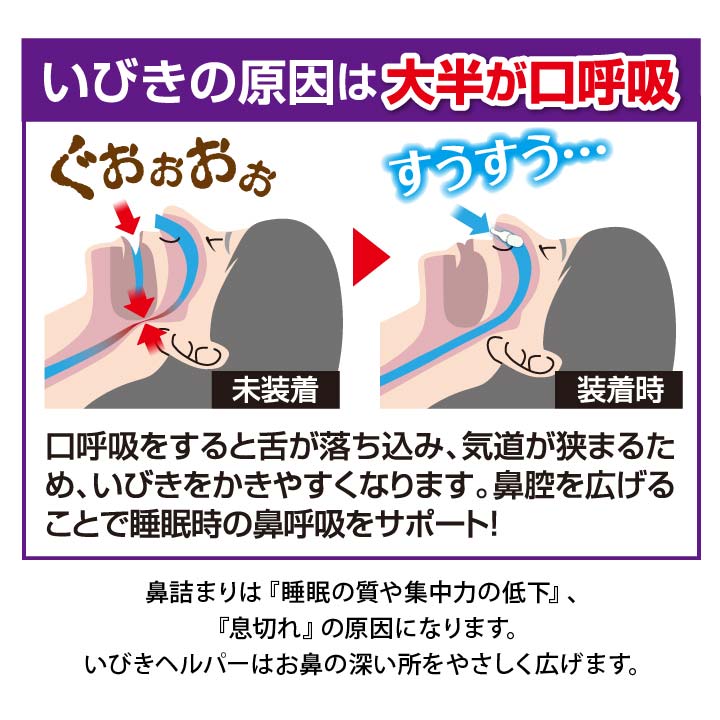 いびきヘルパー airmax Mサイズ いびき イビキ 防止 対策 透明 医療機器 鼻腔拡張器具 鼻呼吸改善 鼻拡張器 痛くない 目立たない 洗える 柔らかい 無臭 気流向上