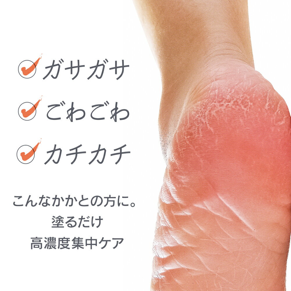 カカトリーヌ モイストローション【メール便発送可能】KAKATOrine Moist Lotion 削らない 角質ケア ひじ ひざ 高濃度ドクダミ ガサガサ かかと 保湿 KAKATO 角質 フットケア カカト ローション