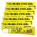 【第(2)類医薬品】エプールH軟膏EXα 25g 5個セット メール便送料無料 / 外用痔疾用薬 痔薬 痔 軟膏 痔の薬