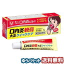 【第(2)類医薬品】 口内炎軟膏大正クイックケア 5g ※セルフメディケーション税制対象商品 メール便送料無料