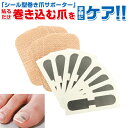 巻き爪 矯正 テープ 日本製 かんたん 貼るだけ シール型 巻き爪 サポーター 足指 グッズ 足爪 保護 シール 足の爪 ケアメタル 痛み 改善 軽減 サポート...