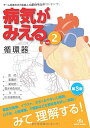 【中古】病気がみえる vol.2 循環器—Medical Disease:An Illustrated Reference
