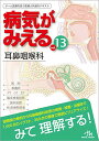【中古】病気がみえる vol.13 耳鼻咽喉科 第1版