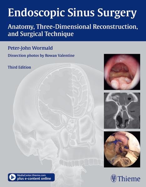 【中古】Endoscopic Sinus Surgery: Anatomy, Three-Dimensional Reconstruction, and Surgical Technique／Wormald, Peter-John, M.D.