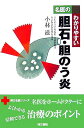 【中古】名医のわかりやすい胆石・胆のう炎 (同文名医シリーズ)/小林 滋