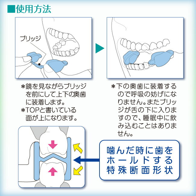 送料無料 メール便 簡単装着 いびきくん 正規販売店 睡眠 安眠 不眠 いびき 防止 対策 健康 フリーサイズ マウスピース トラベルグッズ メリードア