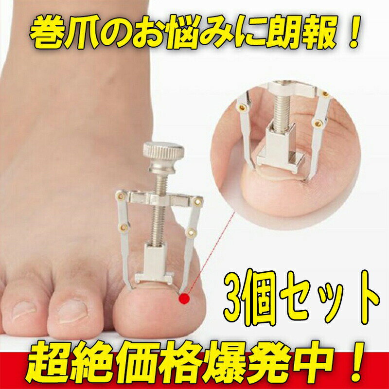 自分でケアできる 巻き爪矯正器 矯正 自分で 補正 矯正 フットケア 巻き爪 巻爪 収納ボックス付き 防止 矯正 巻き爪 ネイル 陥入爪 器具 巻爪ケア セルフケア ツール 巻爪 矯正 まき爪 防止 矯正器具 矯正器具 サポーター ネイルケア