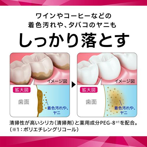 楽天24 ヘルスケア館のセッチマ ハミガキ(40g*6本セット)【セッチマ】[歯磨き粉 口臭 タバコ ホワイトニング 美白]｜アングル3