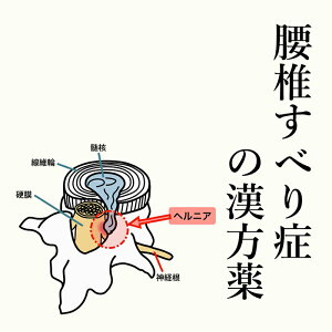 【第2類医薬品】腰椎すべり症の漢方薬 1日2~4回服用 1か月分 漢方薬 腰椎すべり症 薬 しびれ 手 足 首 腰 お薬 てのしびれ 痛み 麻黄 当帰 ヨクイニン 芍薬 シャクヤク 桂皮 手足のしびれ 痺れ 関節痛 筋肉痛 送料無料 電話無料相談・メール相談24時間対応