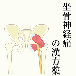 【第2類医薬品】坐骨神経痛の漢方薬 1日2~4回服用 1か月分 漢方薬 坐骨神経痛 薬 漢方 神経痛 しびれ 足 お薬 痛み 足のしびれ 足のしびれに 麻黄 当帰 ヨクイニン 芍薬 シャクヤク 桂皮 痺れ 関節痛 筋肉痛 送料無料 電話無料相談・メール相談24時間対応