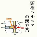 【第2類医薬品】頚椎ヘルニアの漢方薬 1日3回服用 1か月分 頸椎ヘルニア 漢方薬 頚椎ヘルニア ヘルニア 漢方 薬 しびれ 手 足 首 腰 お薬 てのしびれ 痛み 麻黄 当帰 ヨクイニン 芍薬 シャクヤク 桂皮 手足のしびれ 痺れ 関節痛 筋肉痛 電話無料相談・メール相談24時間対応