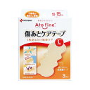 ニチバン アトファイン 傷あとケアテープLサイズ ATK3L 3枚