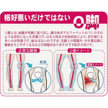 【kilakila*キラキラ】日本製(国産)●O脚対策インソール レディース メンズ o脚 矯正 インソール 中敷き 消臭 なかじき 衝撃吸収 クッション 痛くない 雑貨 ケア用品