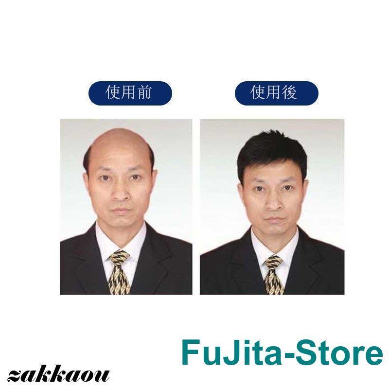 ウィッグ 部分ウィッグ かつら 中高年向け 男性用 自然 お洒落 お年寄り用 ショート イケメン 通気性抜群 大変身