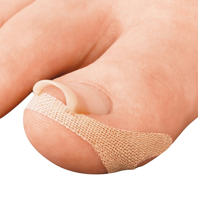 【特典あり】巻き爪テープ クイこまーぬ 60枚入[巻き爪用テープ 巻きづめ テープ ケア 矯正 足 足指] 1-2W