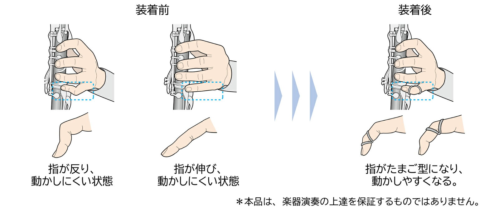 楽器演奏補助器具 Ovaring（オーバリング） 3