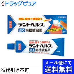 【第3類医薬品】【本日楽天ポイント5倍相当】【●メール便にて送料無料でお届け 代引き不可】ライオンデントヘルスR20g（メール便は発送から10日前後がお届け目安です）【RCP】