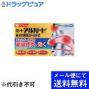 【第(2)類医薬品】【本日楽天ポイント5倍相当】【●メール便にて送料無料でお届け 代引き不可】ロート製薬株式会社 ロートアルガード鼻炎内服薬ゴールドZ 10カプ...