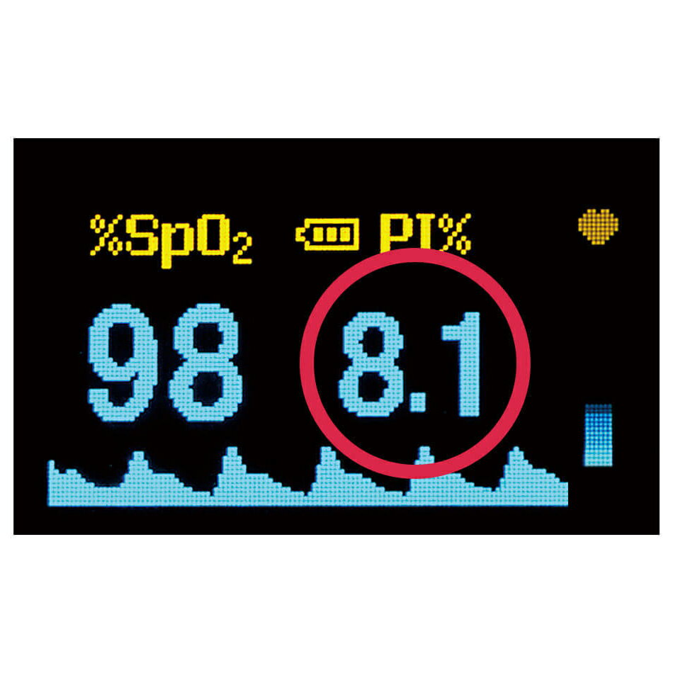 ��3/1����ݥ���Ⱥ���4�ܡ��ۥѥ륹�ե����ڰ��ŵ���ǧ�ڼ����� �������᡼���� �ʡ��� ����˰���� ��ʪ �ʡ������å� �Ǹ�� ���� ��� ��¬ �ѥ륹�������᡼���� �ʡ����꡼ �͵� ���������13267