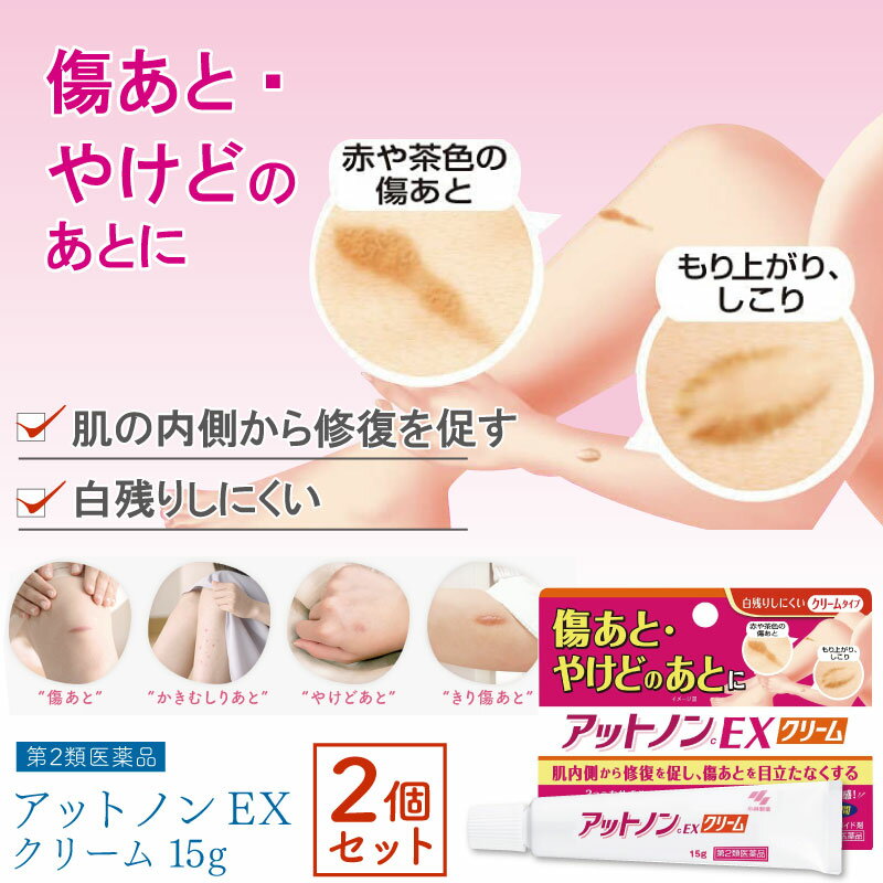 【第2類医薬品】 アットノンEX クリーム 15g ×2個セット アットノン 傷跡 クリーム やけど跡 消す 薬のサムネイル