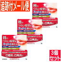 【3個セット】【第(2)類医薬品】デンタルピルクリーム 5g【メール便送料無料/3個セット】