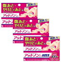 【3個セット】【第2類医薬品】アットノンEX ジェル 15g 小林製薬【メール便送料無料】