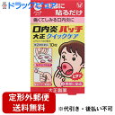 【第(2)類医薬品】【本日楽天ポイント4倍相当】【☆】【定形外郵便で送料無料】大正製薬口内炎パッチ 大正クイックケア 10枚入【セルフメディケーション対象】[関...