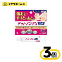 【第2類医薬品】アットノンEX ジェル 15g〔3セット〕