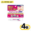 【第2類医薬品】アットノンEX ジェル 15g〔4セット〕